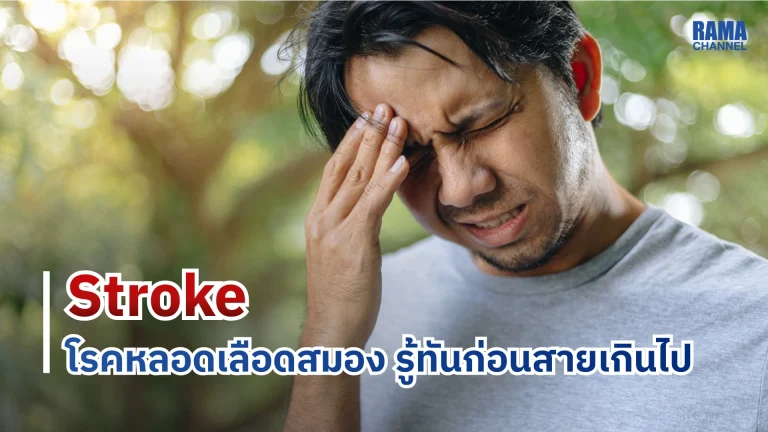 Stroke โรคหลอดเลือดสมอง