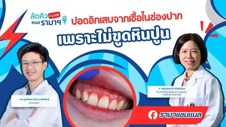 ปอดอักเสบจากเชื้อในช่องปาก-เพราะไม่ขูดหินปูน