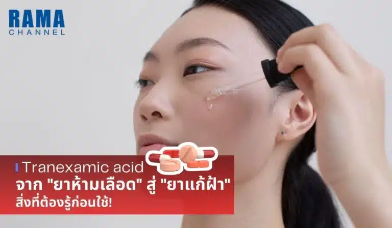 Tranexamic acid จาก ยาห้ามเลือด สู่ ยาแก้ฝ้า สิ่งที่ต้องรู้ก่อนใช้!