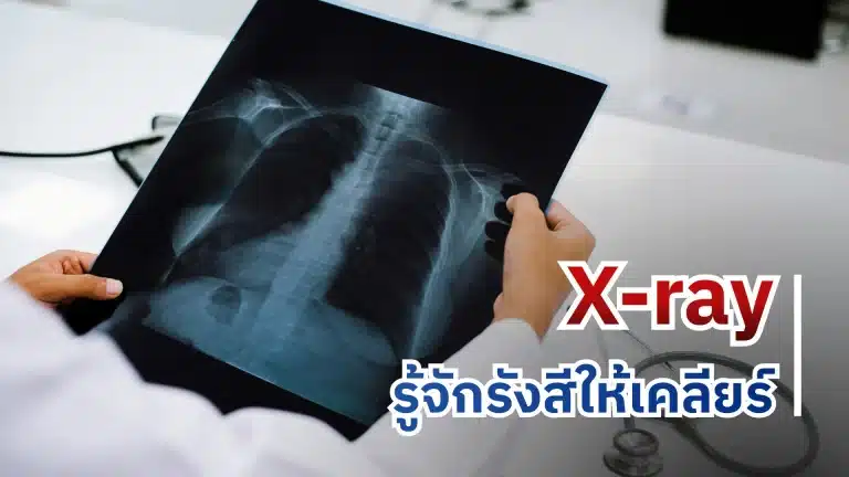 X-ray รู้จักรังสีให้เคลียร์ ๆ