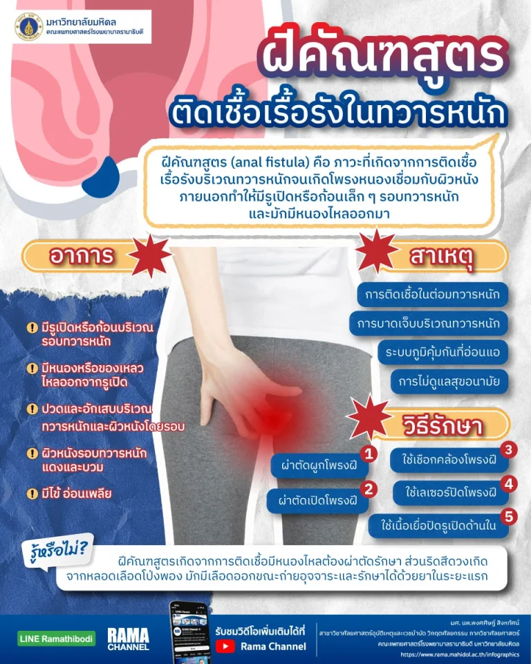 ฝีคัณฑสูตร ติดเชื้อเรื้อรังในทวารหนัก