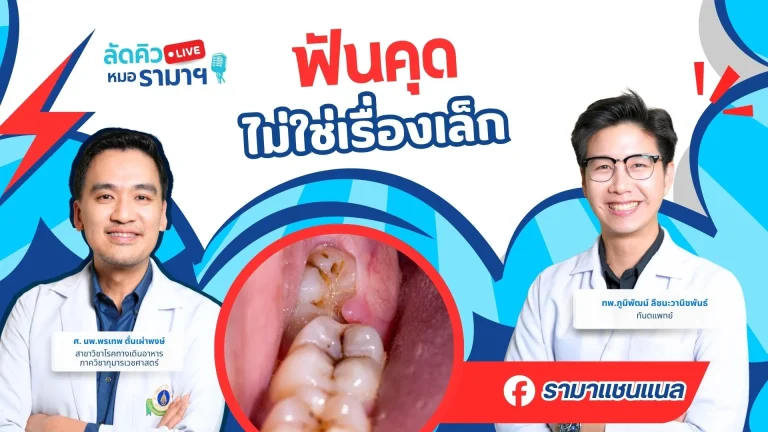 ฟันคุด-ไม่ใช่เรื่องเล็ก
