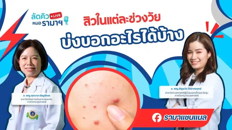 สิวในแต่ละช่วงวัย บ่งบอกอะไรได้บ้าง