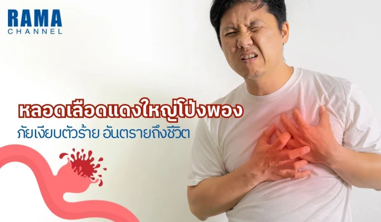 หลอดเลือดแดงใหญ่โป่งพอง ภัยเงียบตัวร้าย อันตรายถึงชีวิต