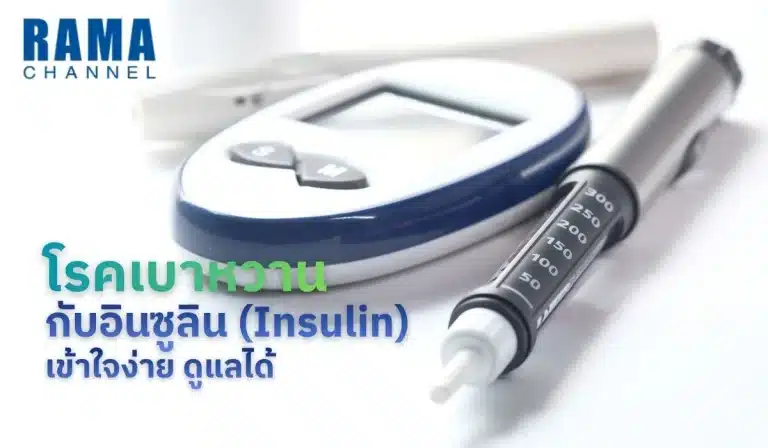 โรคเบาหวานกับอินซูลิน (Insulin) เข้าใจง่าย ดูแลได้