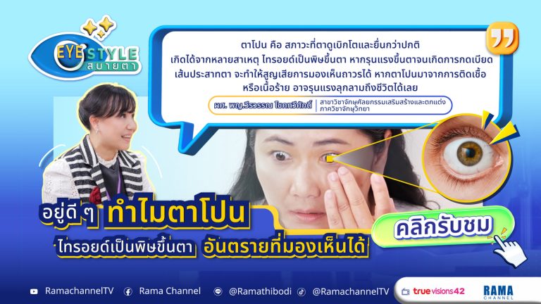 ตาโปนอาจเป็นสัญญาณของไทรอยด์เป็นพิษขึ้นตา