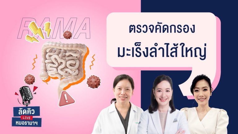 การตรวจคัดกรองมะเร็งลำไส้ใหญ่