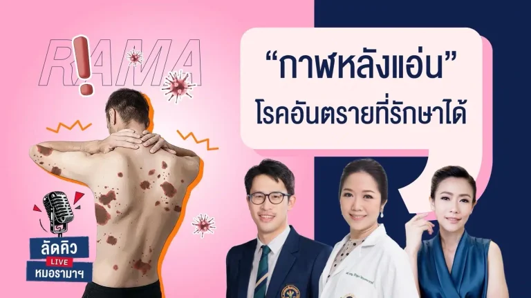 กาฬหลังแอ่น โรคอันตรายที่รักษาได้