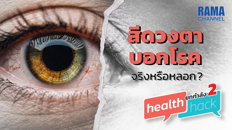 รายการ Health Hack เรื่อง ดวงตา เป็นอวัยวะที่สำคัญเพราะช่วยในการมองเห็น ดังนั้น ความเชื่อที่ว่า สีดวงตา ที่ผิดปกติสามารถบอกโรคได้ จะจริงหรือไม่ ?