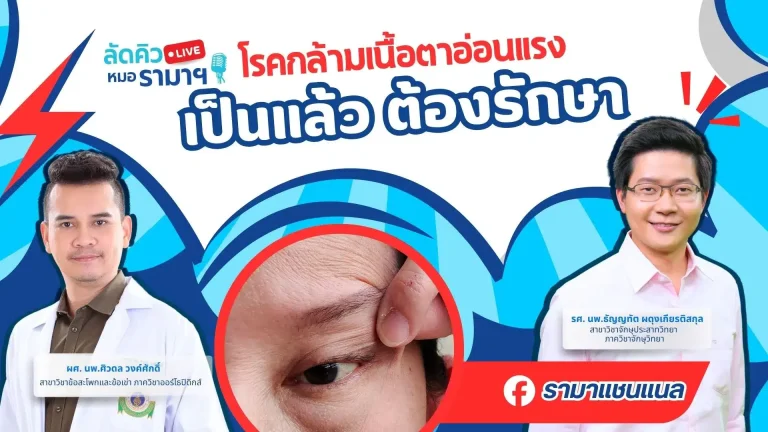 โรคกล้ามเนื้อตาอ่อนแรง-เป็นแล้วต้องรักษา