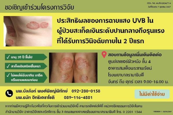 ขอเชิญเข้าร่วมโครงการวิจัยประสิทธิผลของการฉายแสง UVB ในผู้ป่วยสะเก็ดเงิน