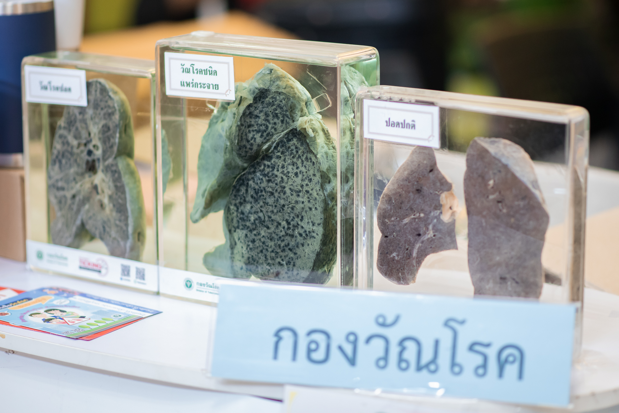 งาน “วันวัณโรคโลก” World Tuberculosis Day 2023 งาน “วันวัณโรคโลก” World Tuberculosis Day 2023