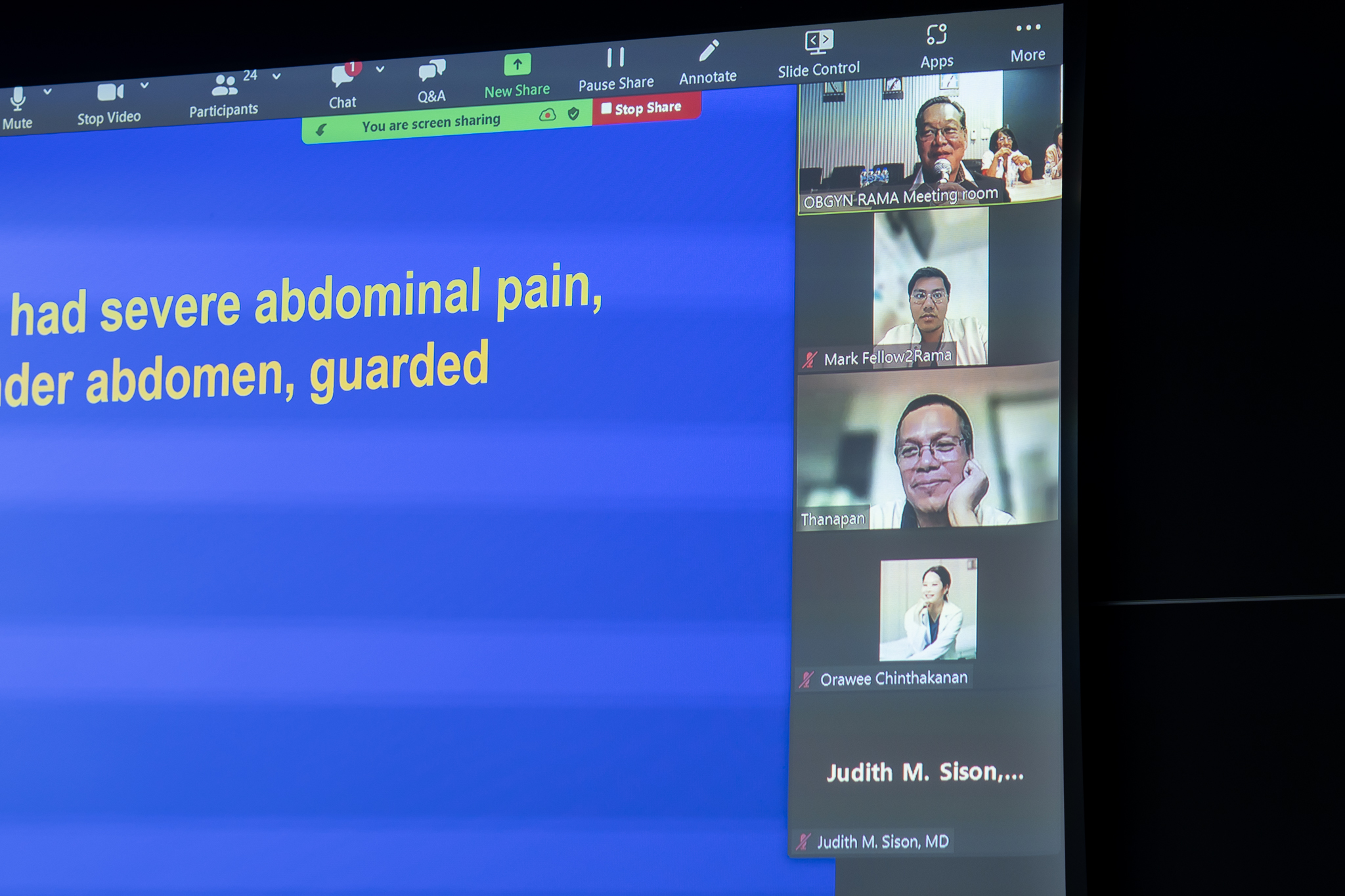 งานบรรยายพิเศษ หัวข้อ UPDATE IN THE PROGRESS OF MANAGEMENT OF STRESS URINARY INCONTINENCE