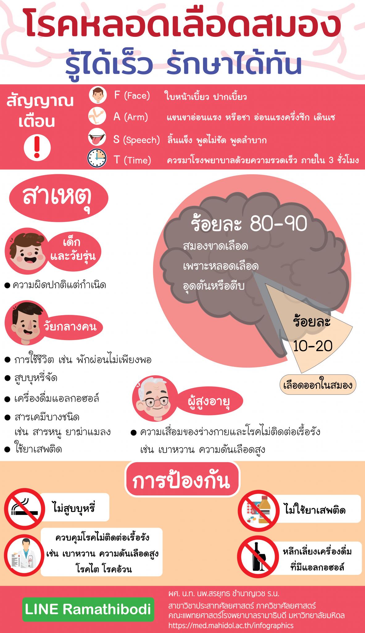 โรคหลอดเลือดสมอง รู้ได้เร็ว รักษาได้ทัน