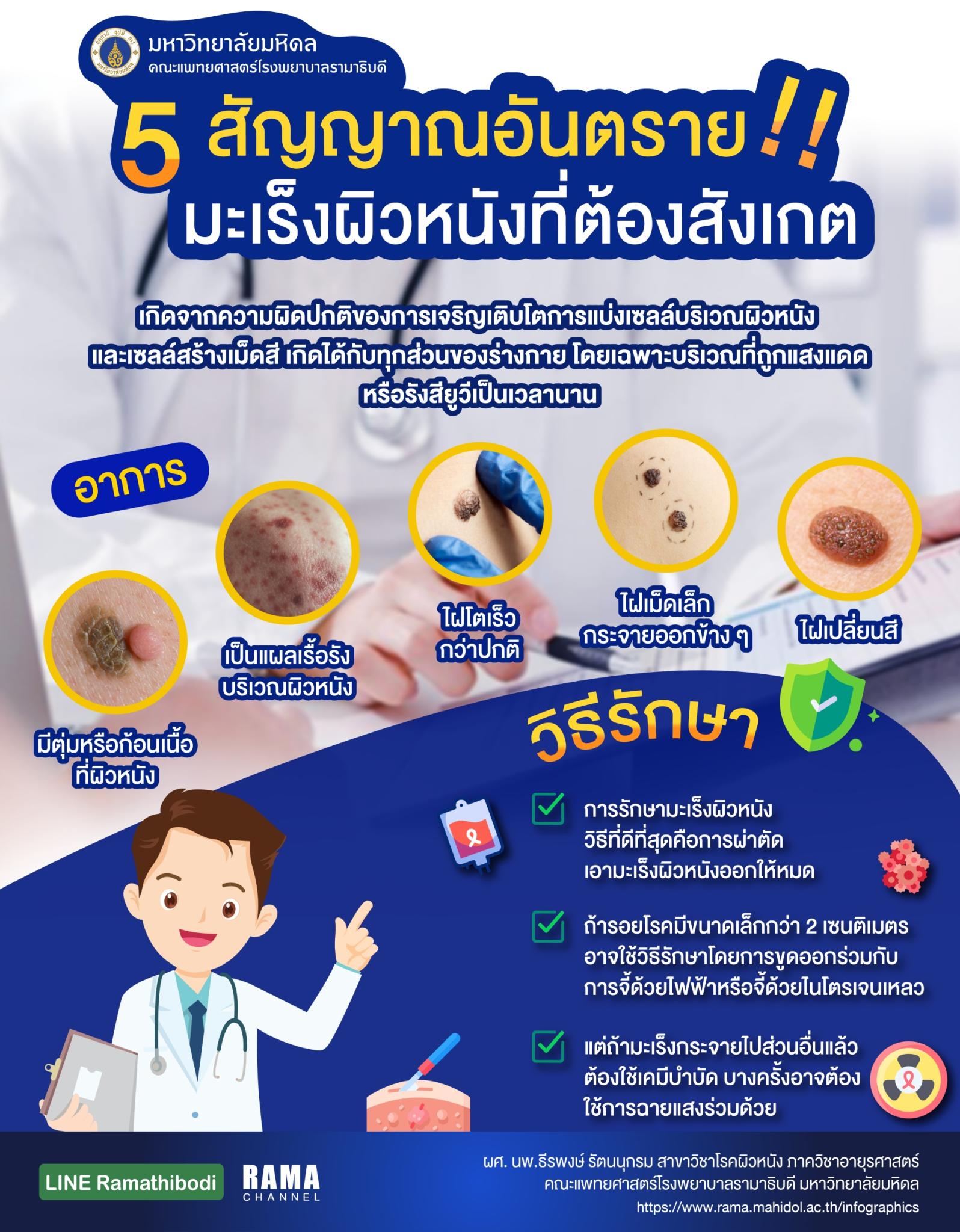 5 สัญญาณอันตราย!! มะเร็งผิวหนังที่ต้องสังเกต