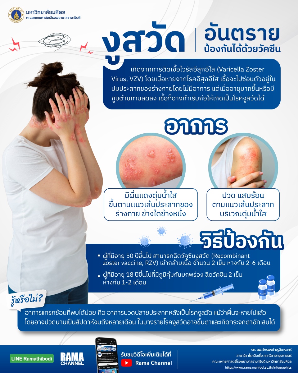 งูสวัด อันตรายป้องกันได้ด้วยวัคซีน