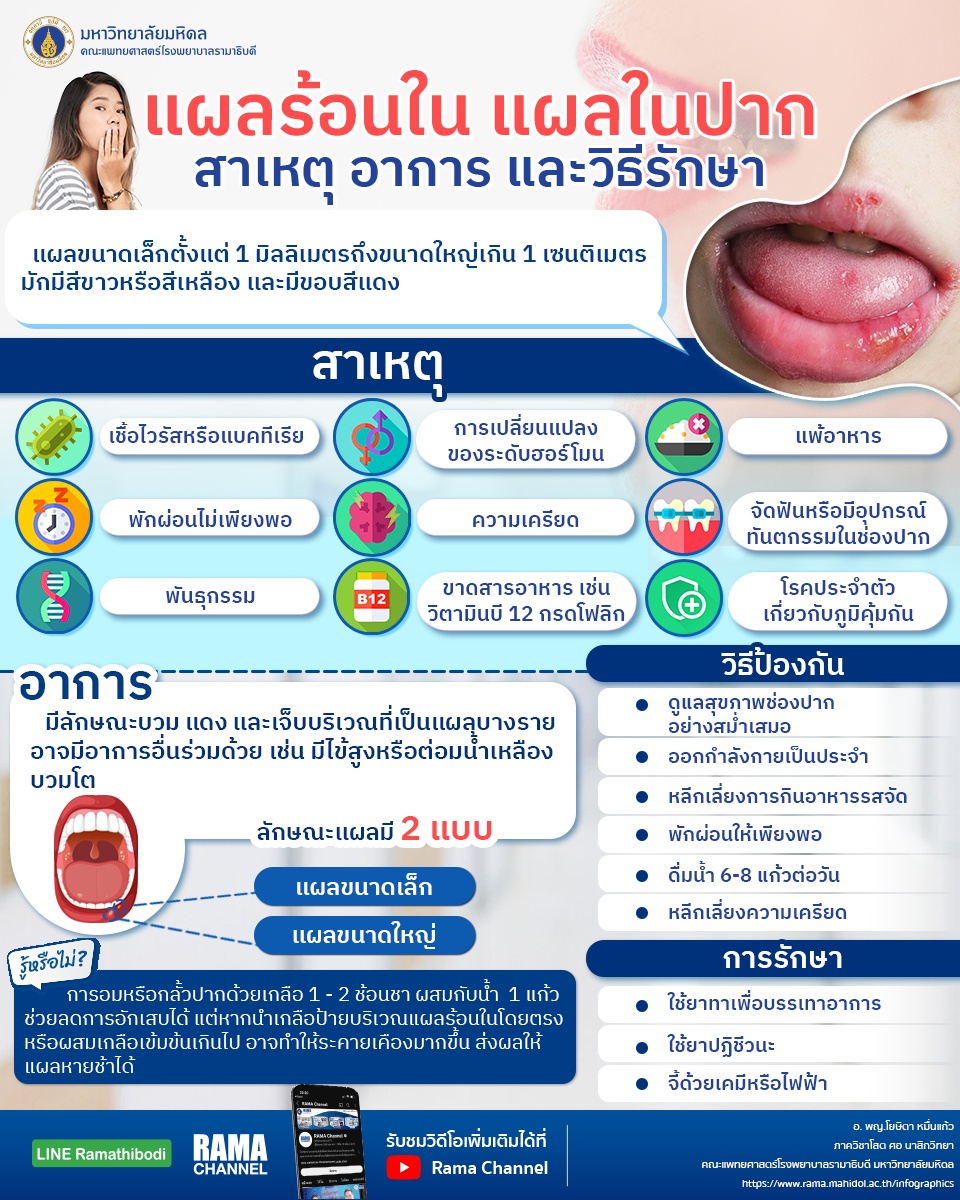 แผลร้อนใน แผลในปาก