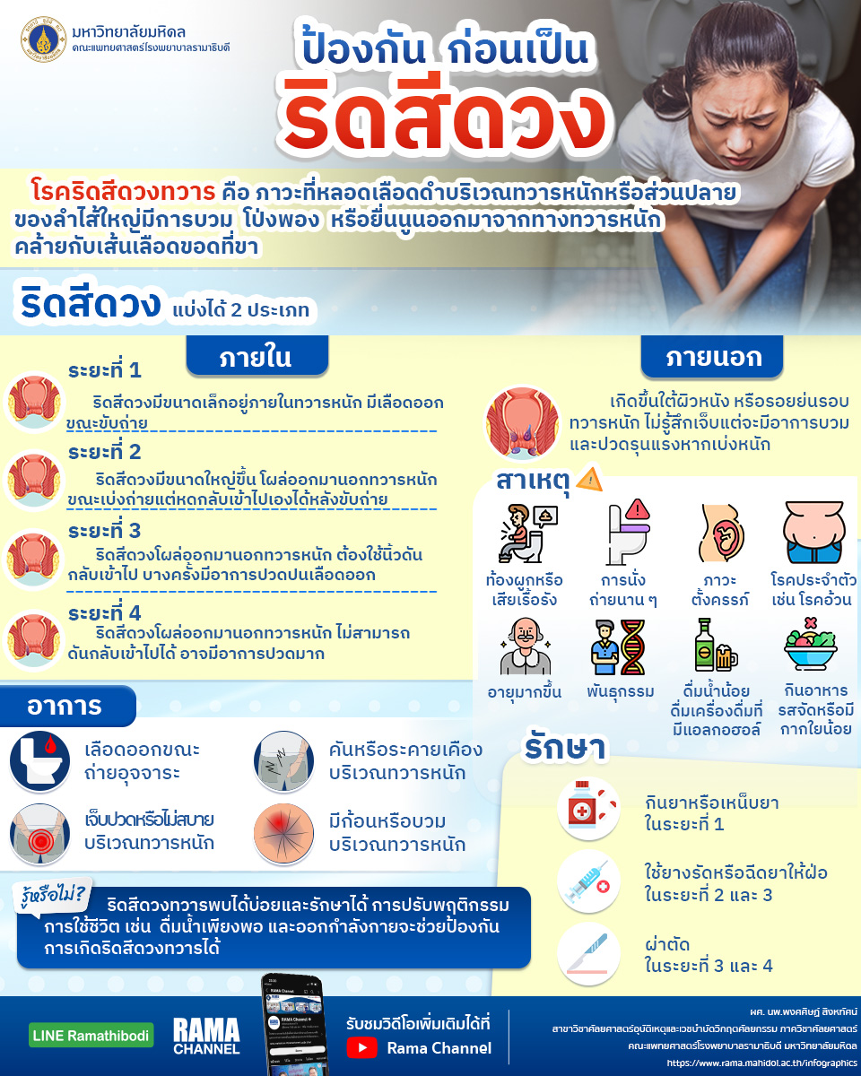 ป้องกัน ก่อนเป็นริดสีดวง ป้องกัน ก่อนเป็นริดสีดวง