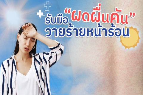 รับมือ “ผดผื่นคุ้น” วายร้ายหน้าร้อน