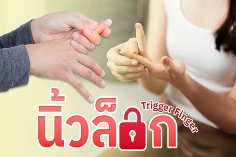 นิ้วล็อก