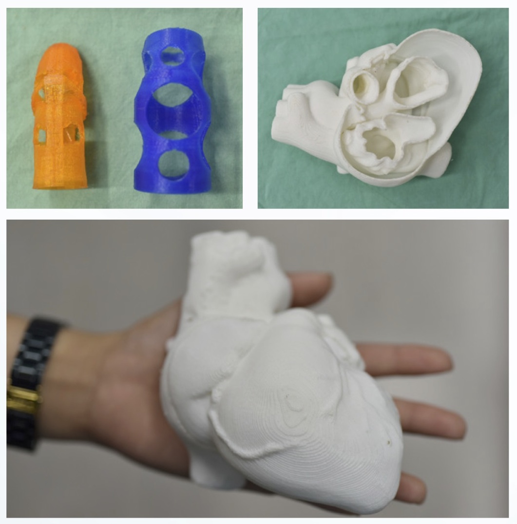 สร้างสรรค์นวัตกรรมทางการแพทย์ด้วย 3D Printing