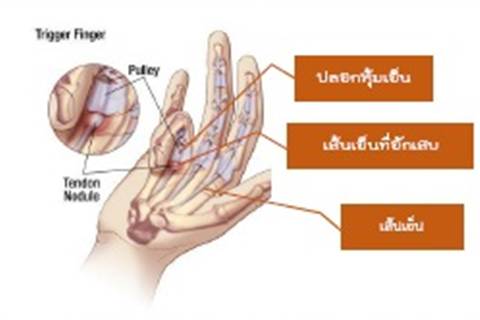 จุลสารอาชีวอนามัย ฉบับที่ 22 ประจำเดือน พฤศจิกายน 2558