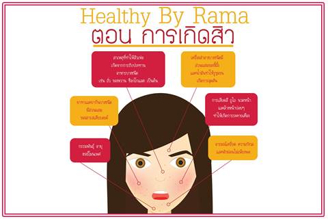 Healthy By Rama ตอน การเกิดสิว
