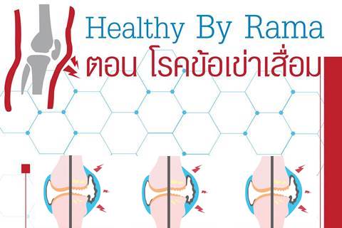 Healthy By Rama ตอน โรคข้อเข่าเสื่อม