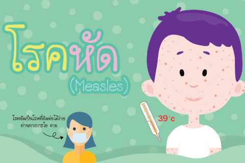 โรคหัด (Measles)