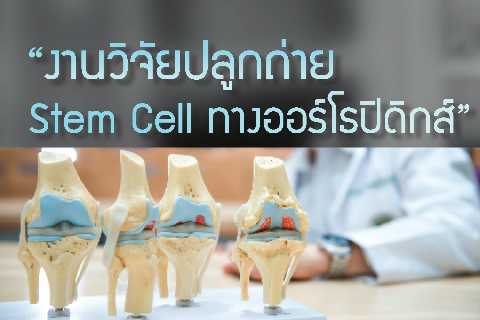 “งานวิจัยปลูกถ่าย Stem Cell ทางออร์โธปิดิกส์”