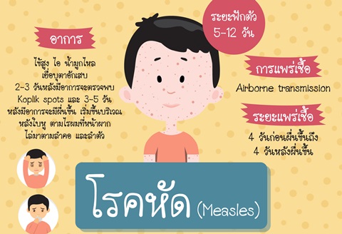 โรคหัด (Measles)