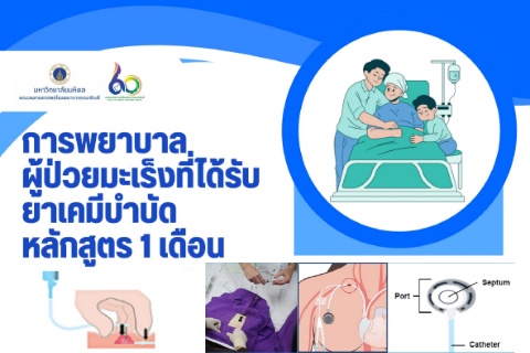 การพยาบาลผู้ป่วยมะเร็งที่ได้รับยาเคมีบำบัด หลักสูตร 1 เดือน