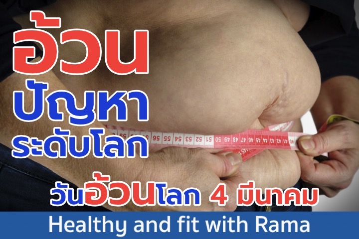 อ้วน ปัญหา ระดับโลก วันอ้วนโลก 4 มีนาคม