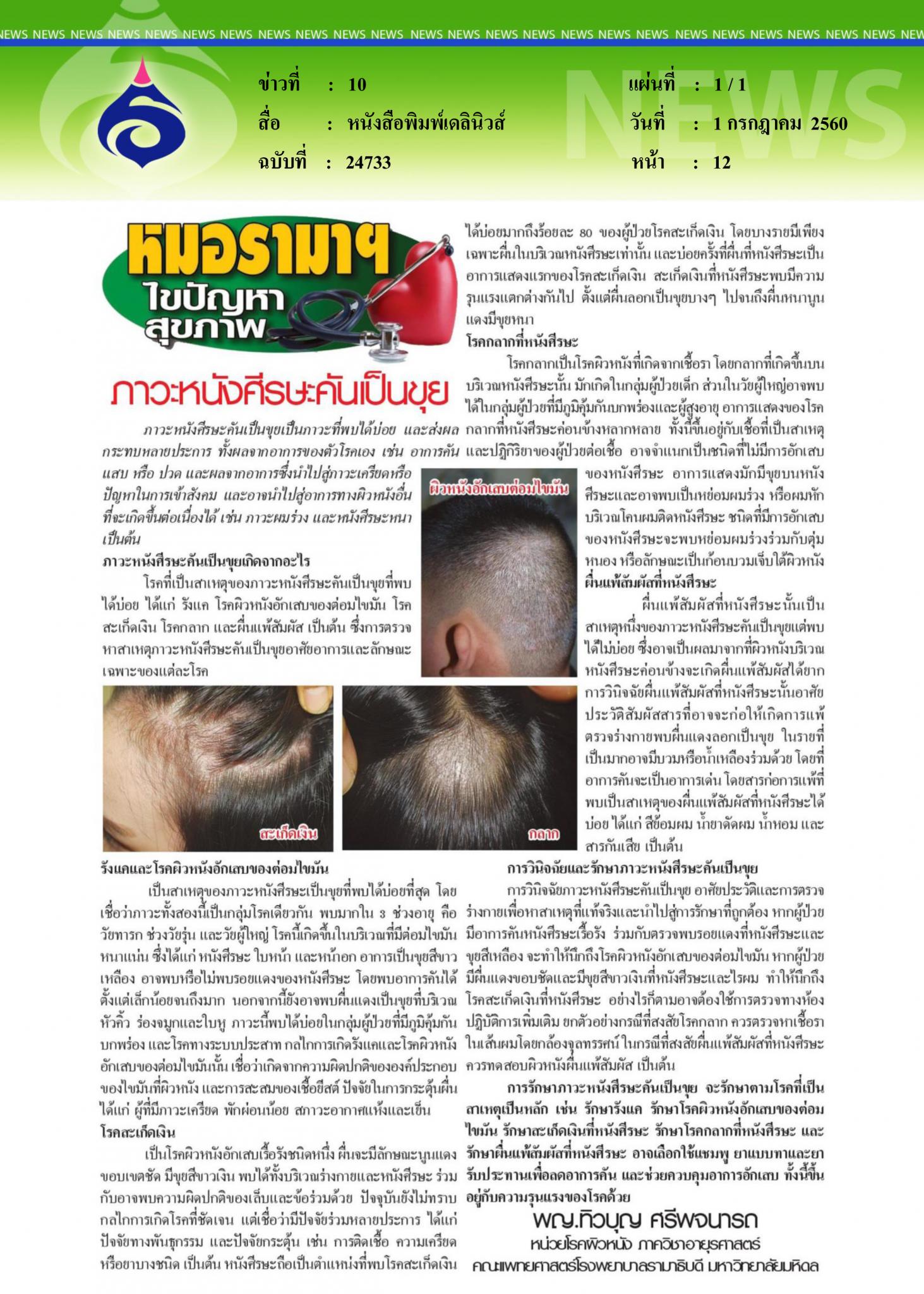 หนังสือพิมพ์เดลินิวส์, ภาวะหนังศีรษะคันเป็นขุย