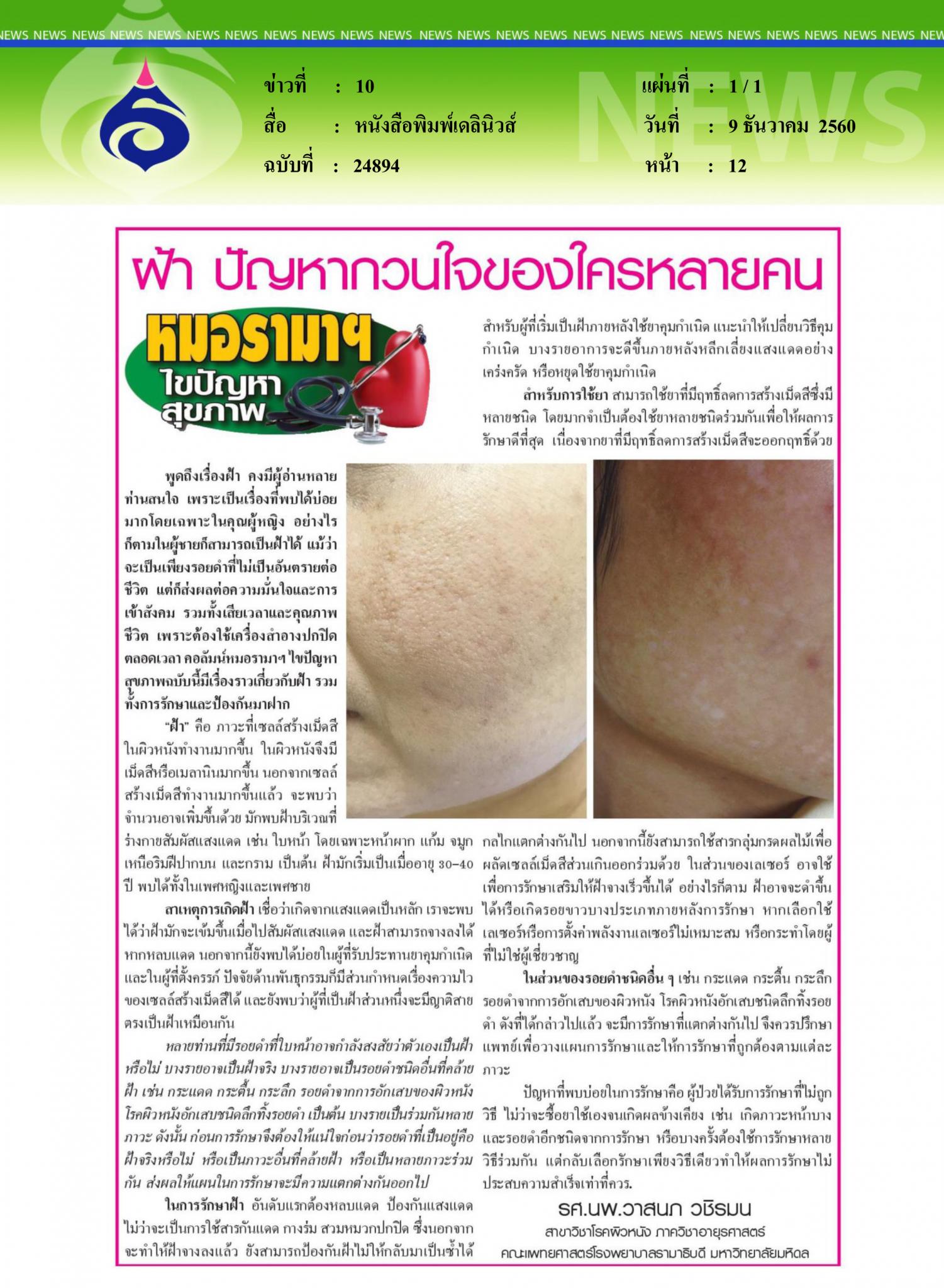 หนังสือพิมพ์เดลินิวส์ : ฝ้า ปัญหากวนใจของใครหลายคน
