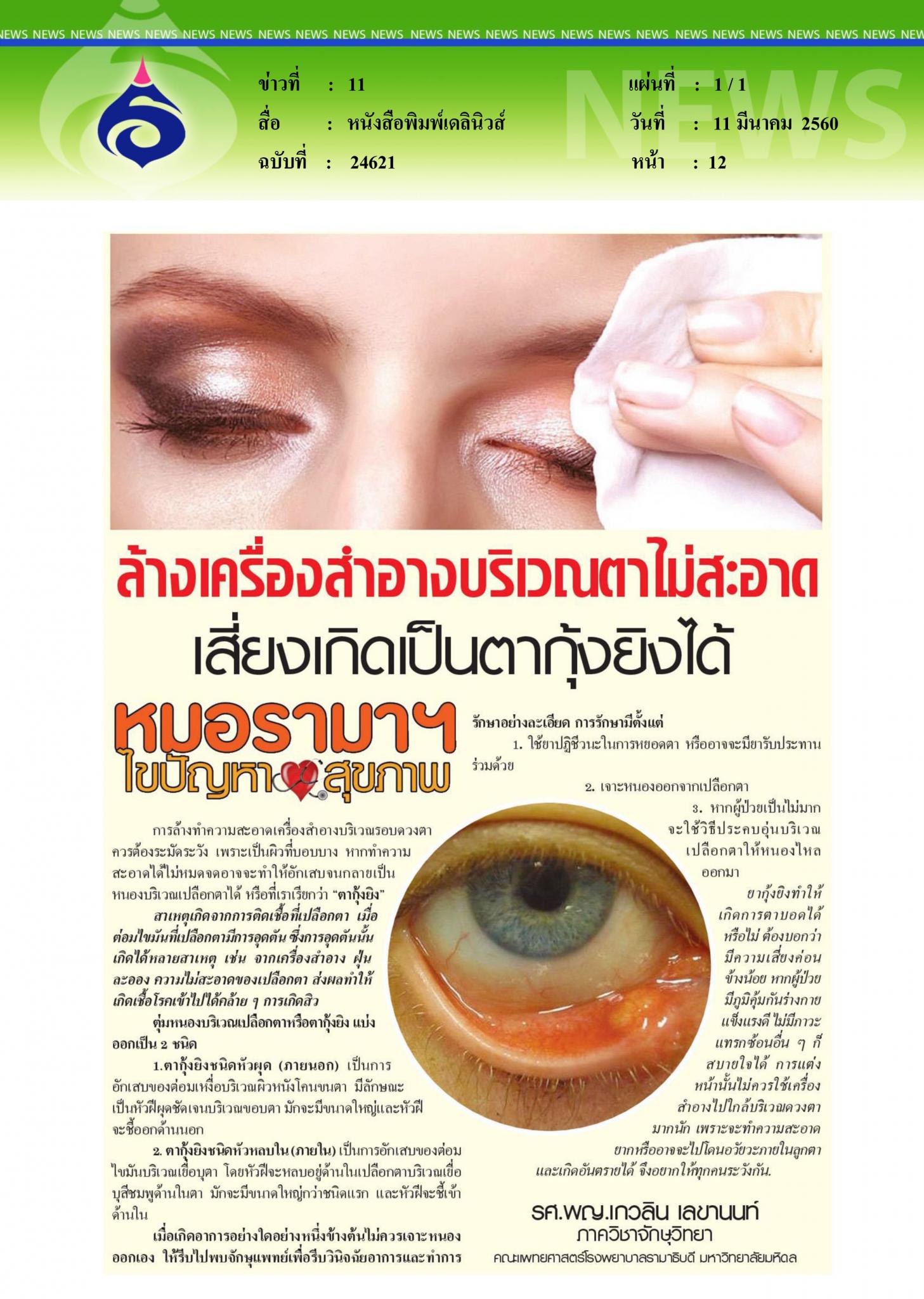 หนังสือพิมพ์เดลินิวส์, ล้างเครื่องสำอางบริเวณตาไม่สะอาดเสี่ยงเป็นตากุ้งยิง
