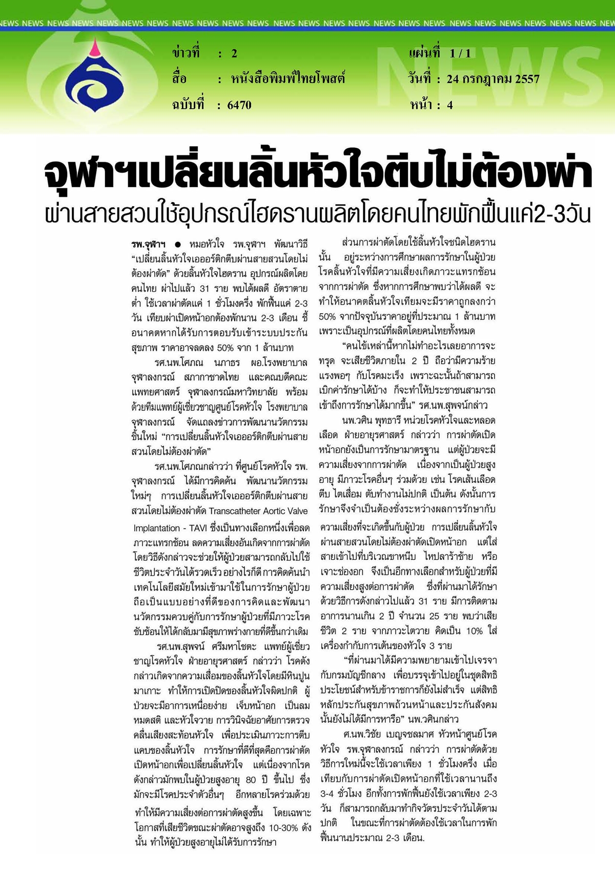 ไทยโพสต์ : จุฬาฯ เปลี่ยนลิ้นหัวใจตีบไม่ต้องผ่า