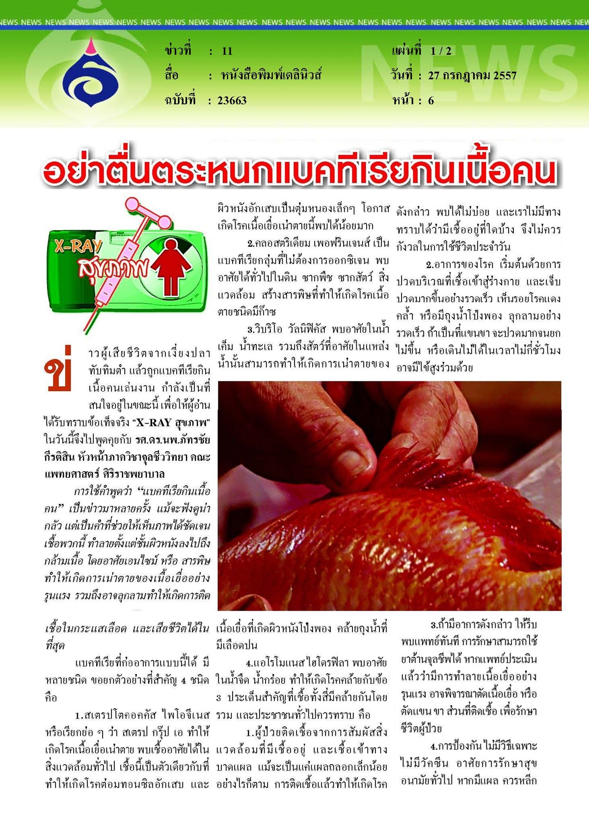 เดลินิวส์ : อย่าตื่นตระหนกแบดทีเรียกินเนื้อคน