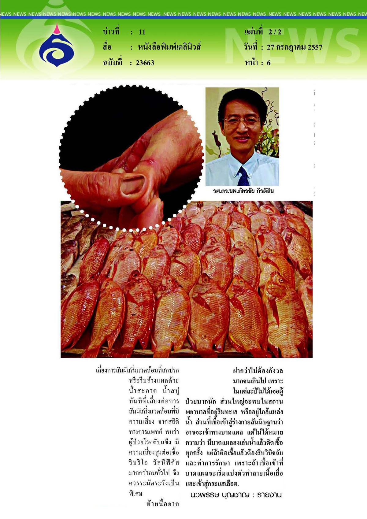 เดลินิวส์ : อย่าตื่นตระหนกแบดทีเรียกินเนื้อคน