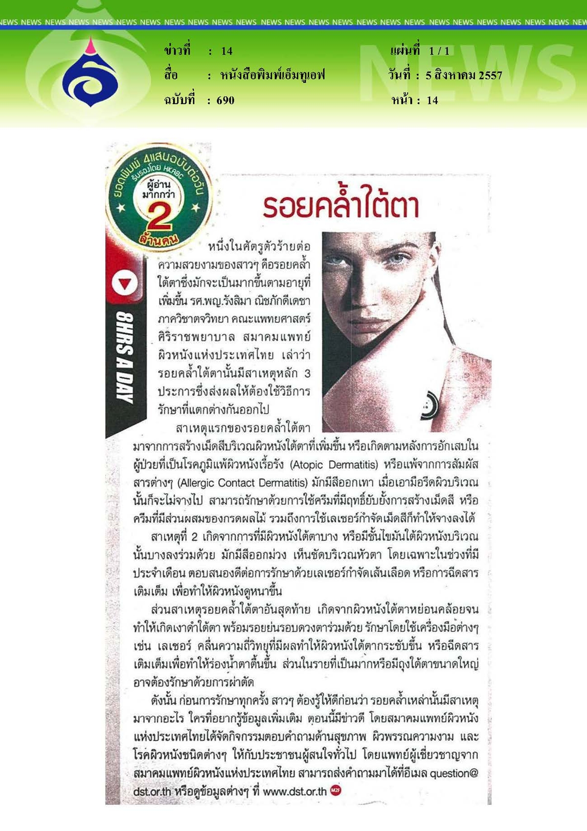 เอ็มทูเอฟ : รอยคล้ำใต้ตา