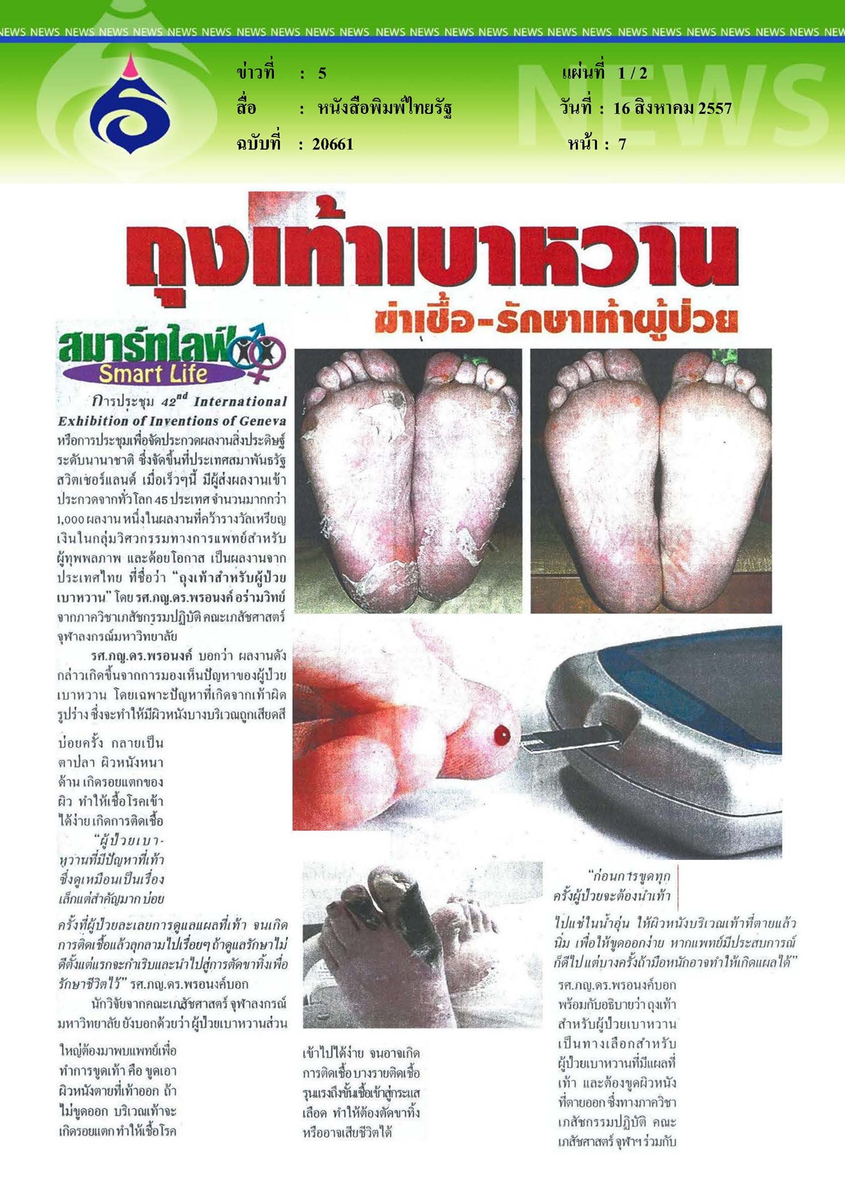 ไทยรัฐ : ถุงเท้าเบาหวาน ฆ่าเชื้อ-รักษาเท้าผู้ป่วย