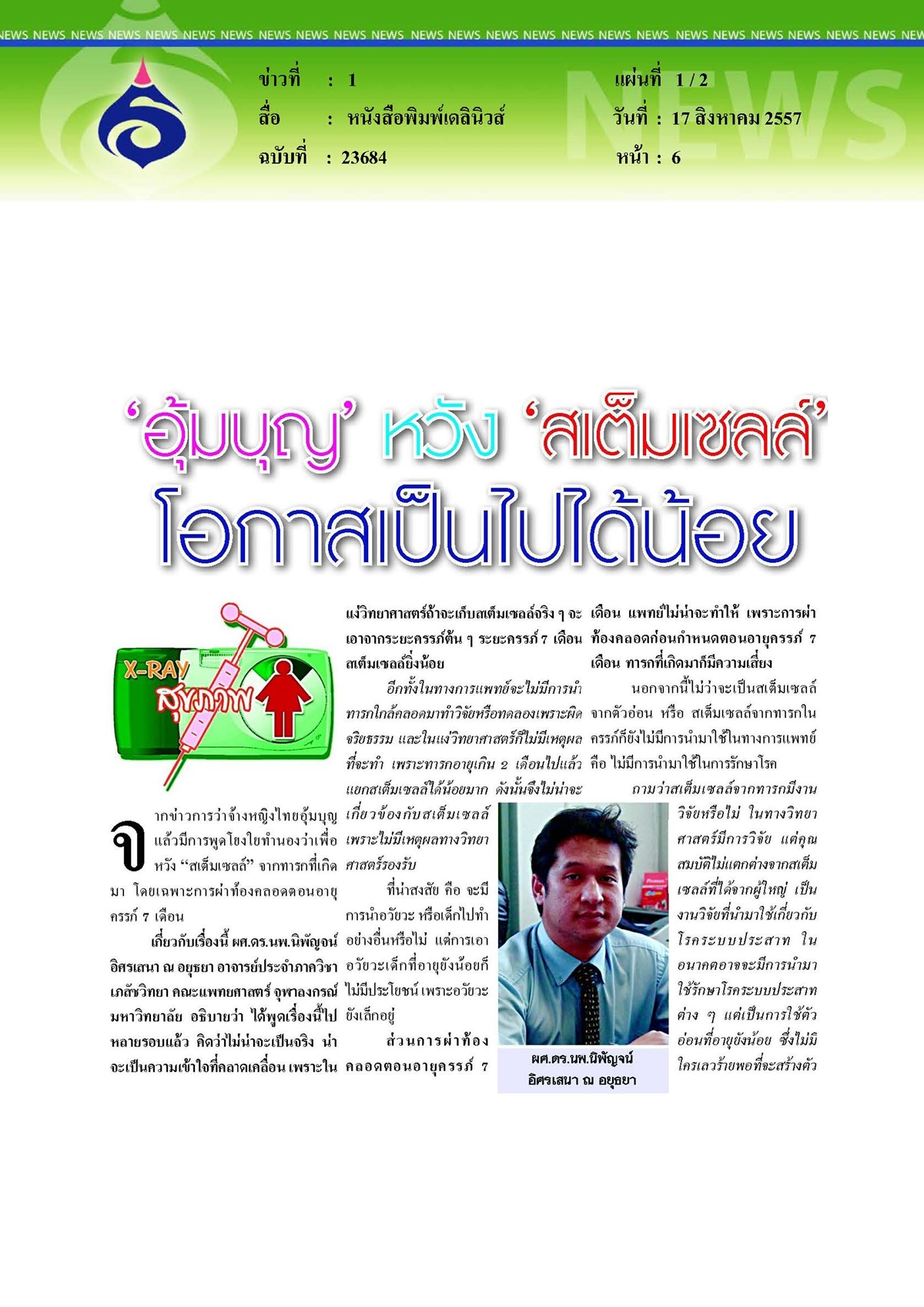 เดลินิวส์ : อุ้มบุญหวังสเต็มเซลล์