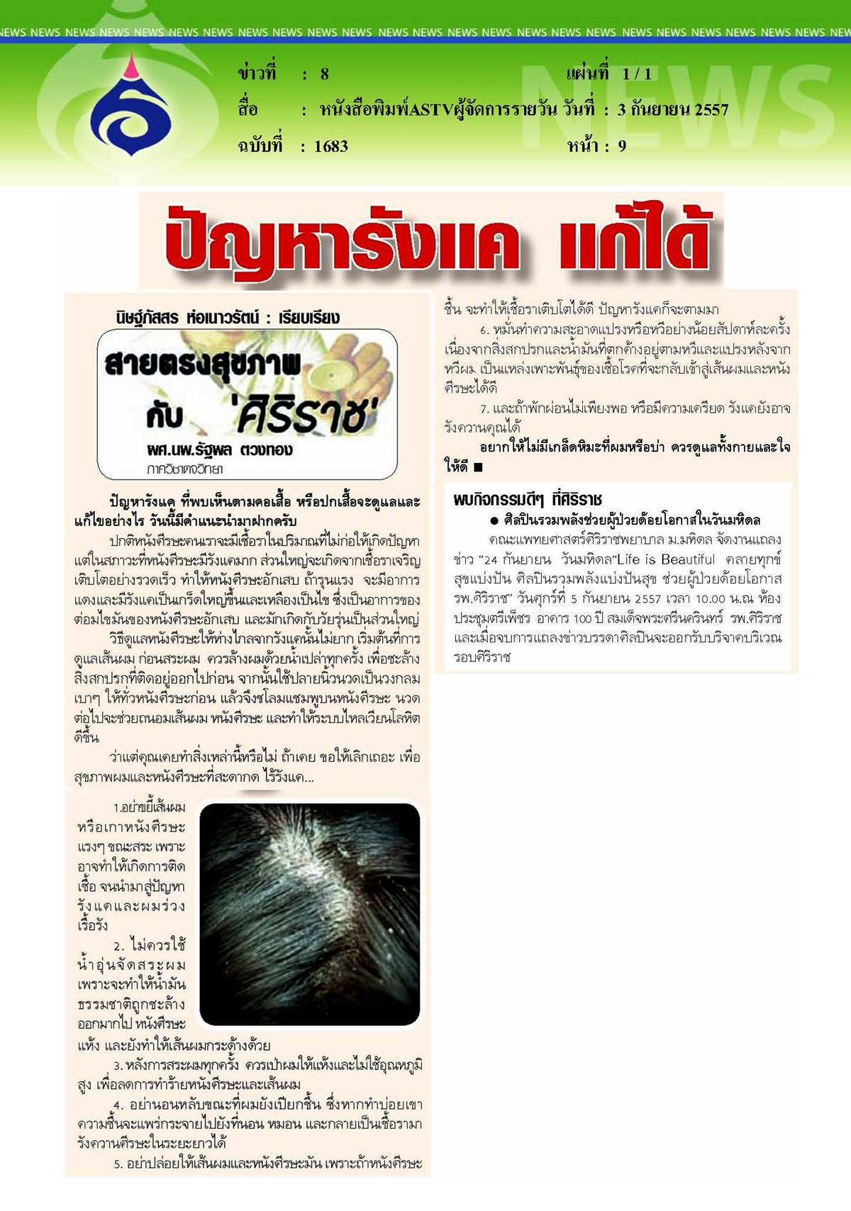 ASTVผู้จัดการรายวัน : ปัญหารังแคแก้ได้