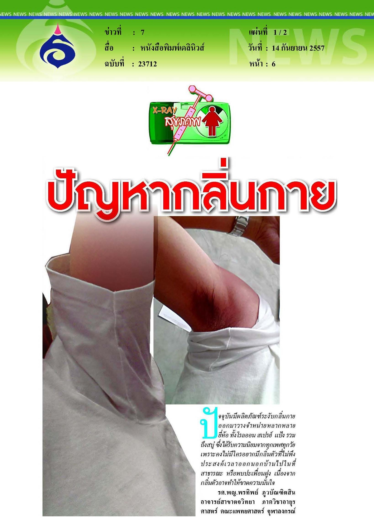 เดลินิวส์ : ปัญหากลิ่นกาย