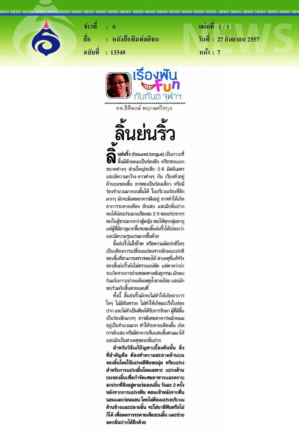 มติชน : ลิ้นย่นริ้ว