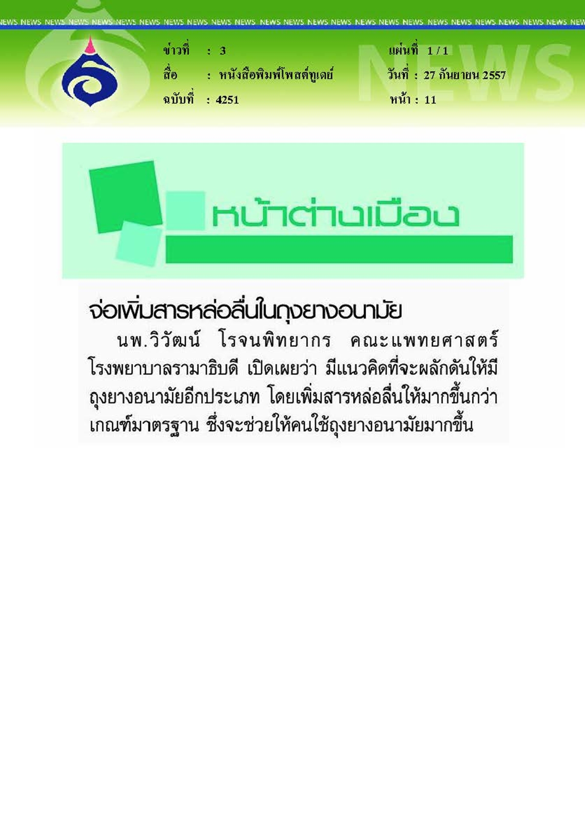 โพสต์ทูเดย์ : จ่อเพิ่มสารหล่อลื่นในถุงยางอนามัย
