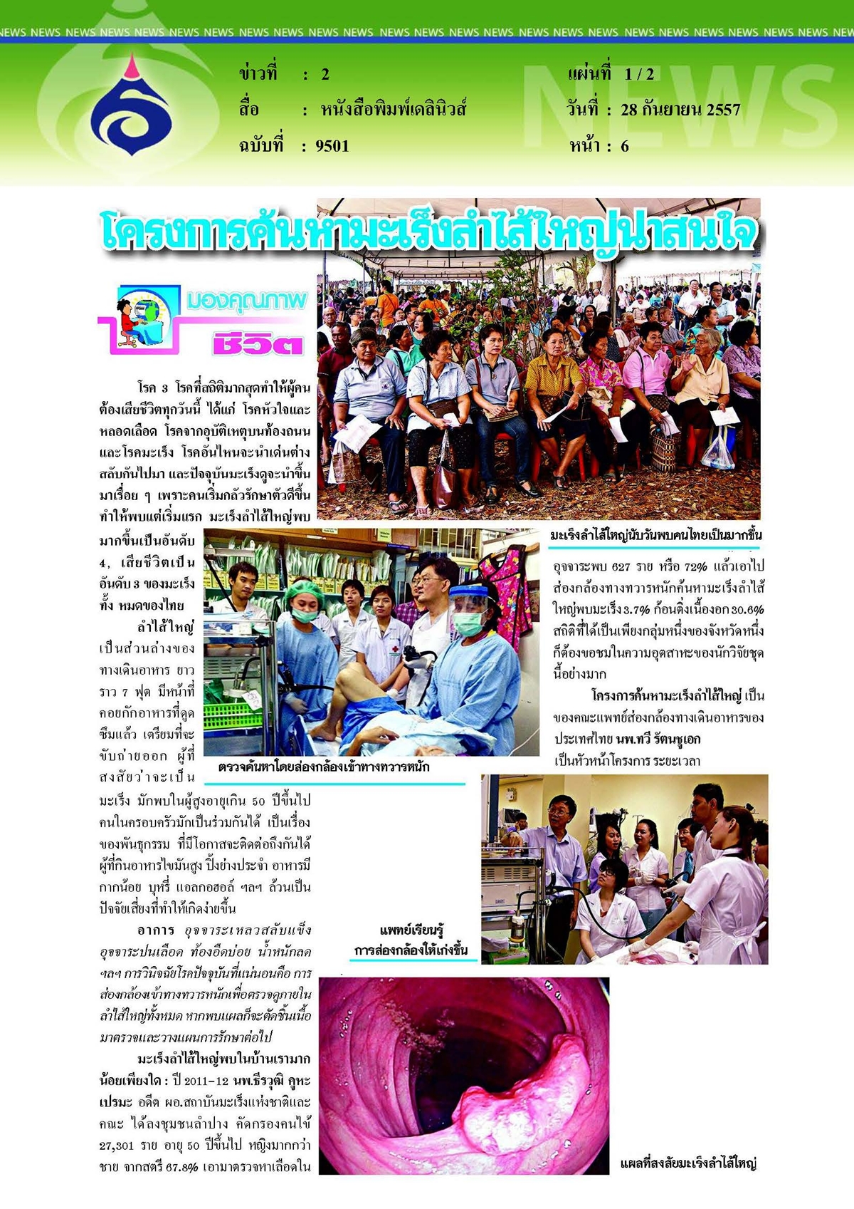 เดลินิวส์ : โครงการค้นหามะเร็งลำไส้ใหญ่น่าสนใจ