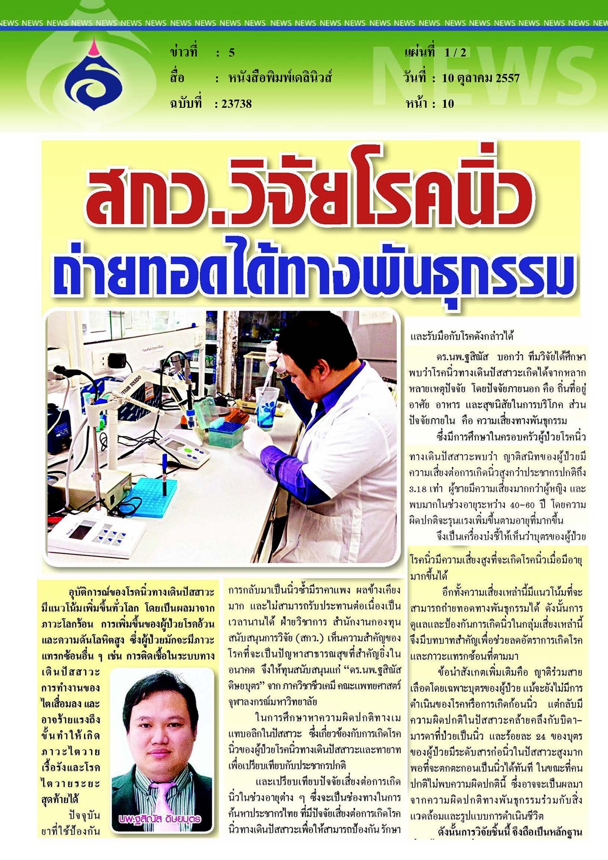 เดลินิวส์ : วิจัยโรคนิ่วถ่ายทอดได้ทางพันธุกรรม