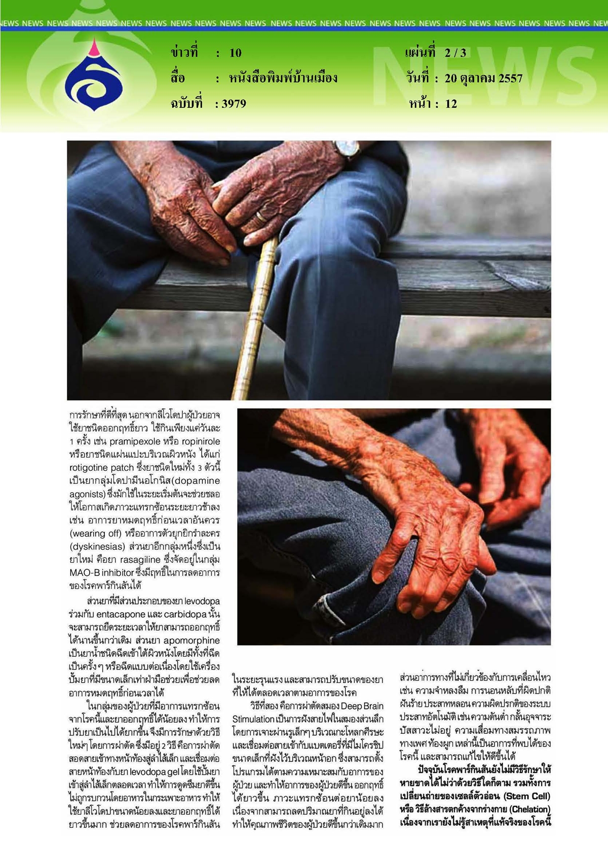 กรุงเทพธุรกิจ : โรคพาร์กินสันไม่ใช่แค่อาการสั่น