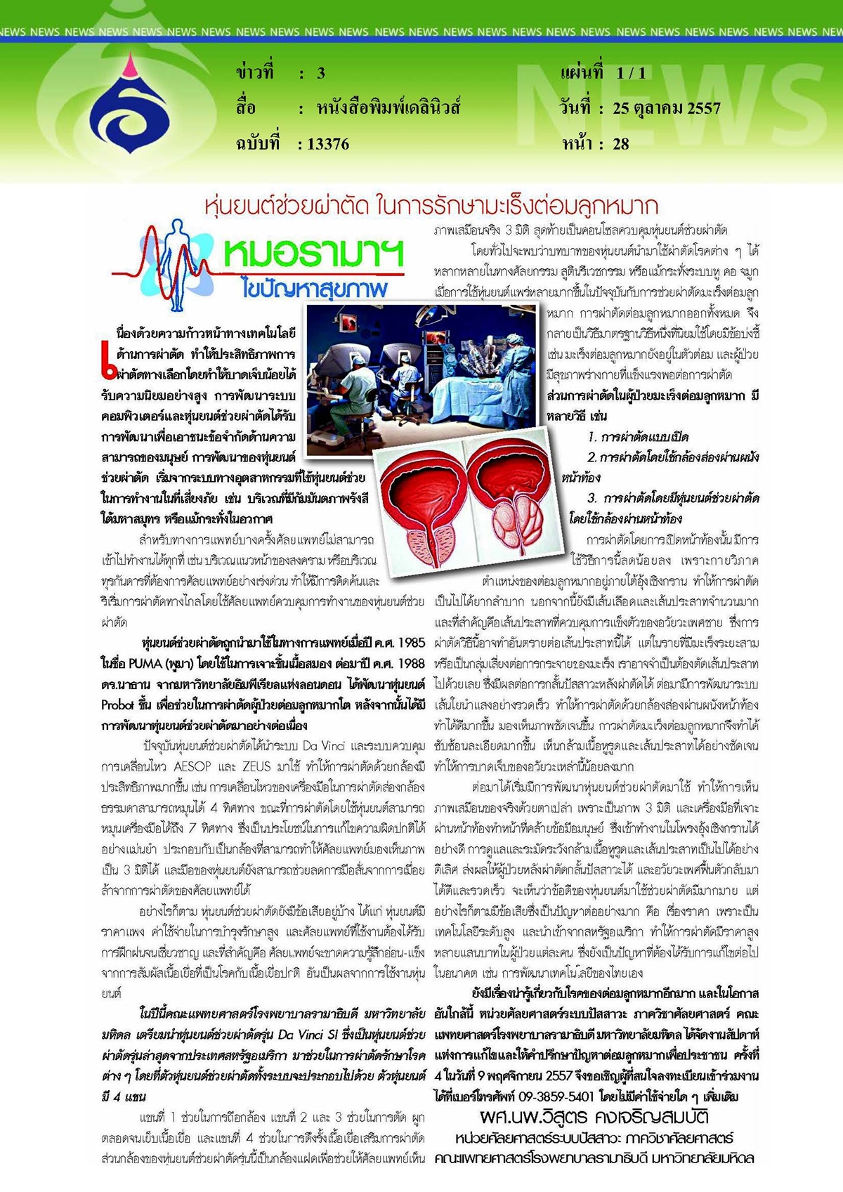 เดลินิวส์ : หุ่นยนต์ช่วยผ่าตัด ในการรักษามะเร็งต่อมลูกหมาก